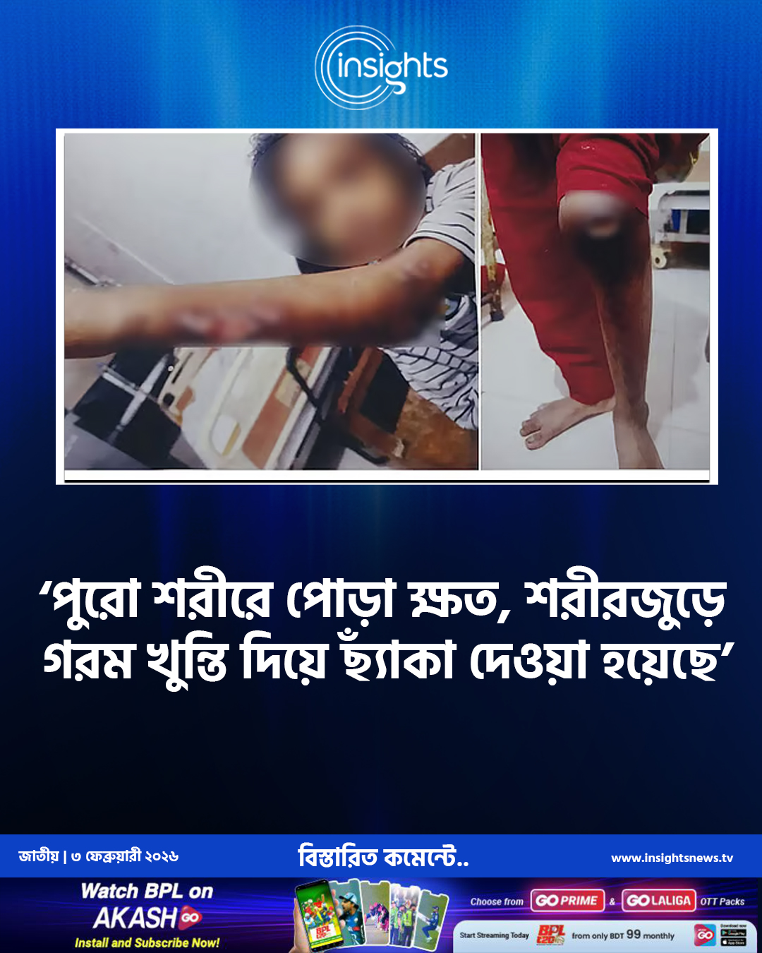 উত্তরায় গৃহকর্মী শিশুর ওপর নির্যাতনের অভিযোগ, হাসপাতালে ভর্তি